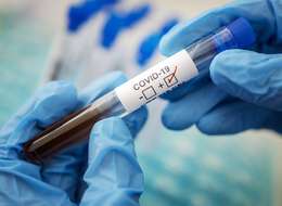ᐉ Тесты на коронавирус и антитела: все, что вы хотели знать – Блог Liki.Wiki