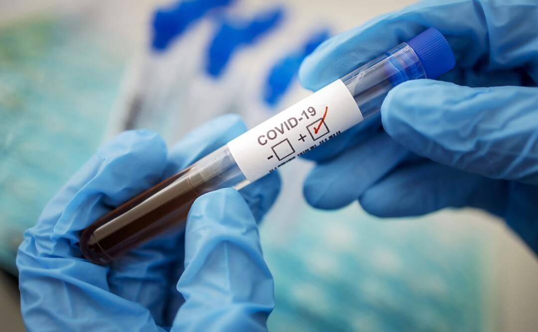 Тесты на коронавирус и антитела: все, что вы хотели знать
