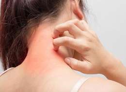 ᐉ Аллергический дерматит: причины, симптомы, диагностика, лечение и профилактика